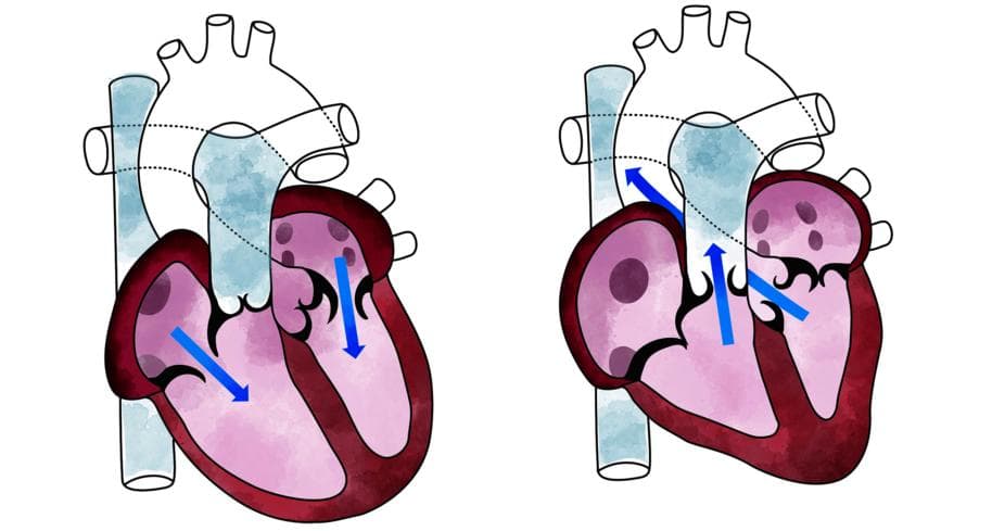 Come Si Chiama La Contrazione Del Cuore