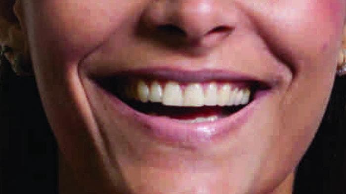 Contro le carie mangiate il cioccolato fondente