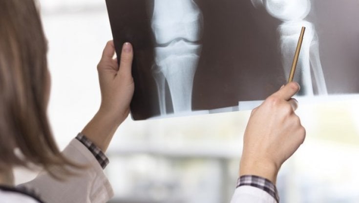 Osteoporosi, con il freddo aumentano le fratture