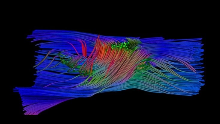 Non è più un tabu, il midollo spinale si può riparare