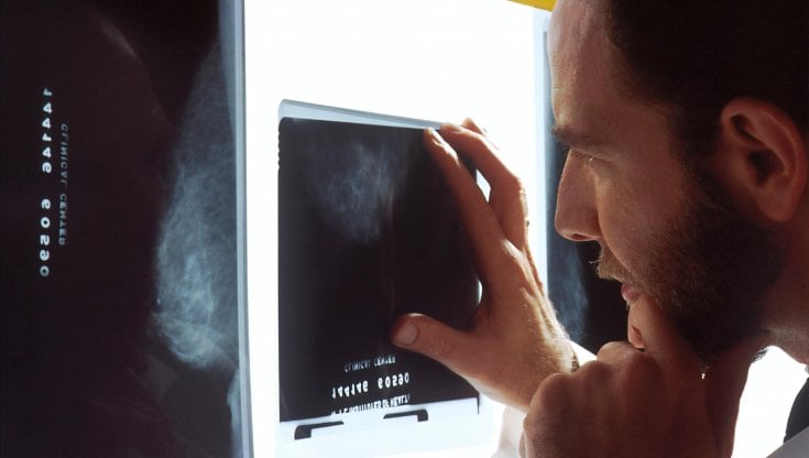 Mammografia a 40 anni per personalizzare lo screening