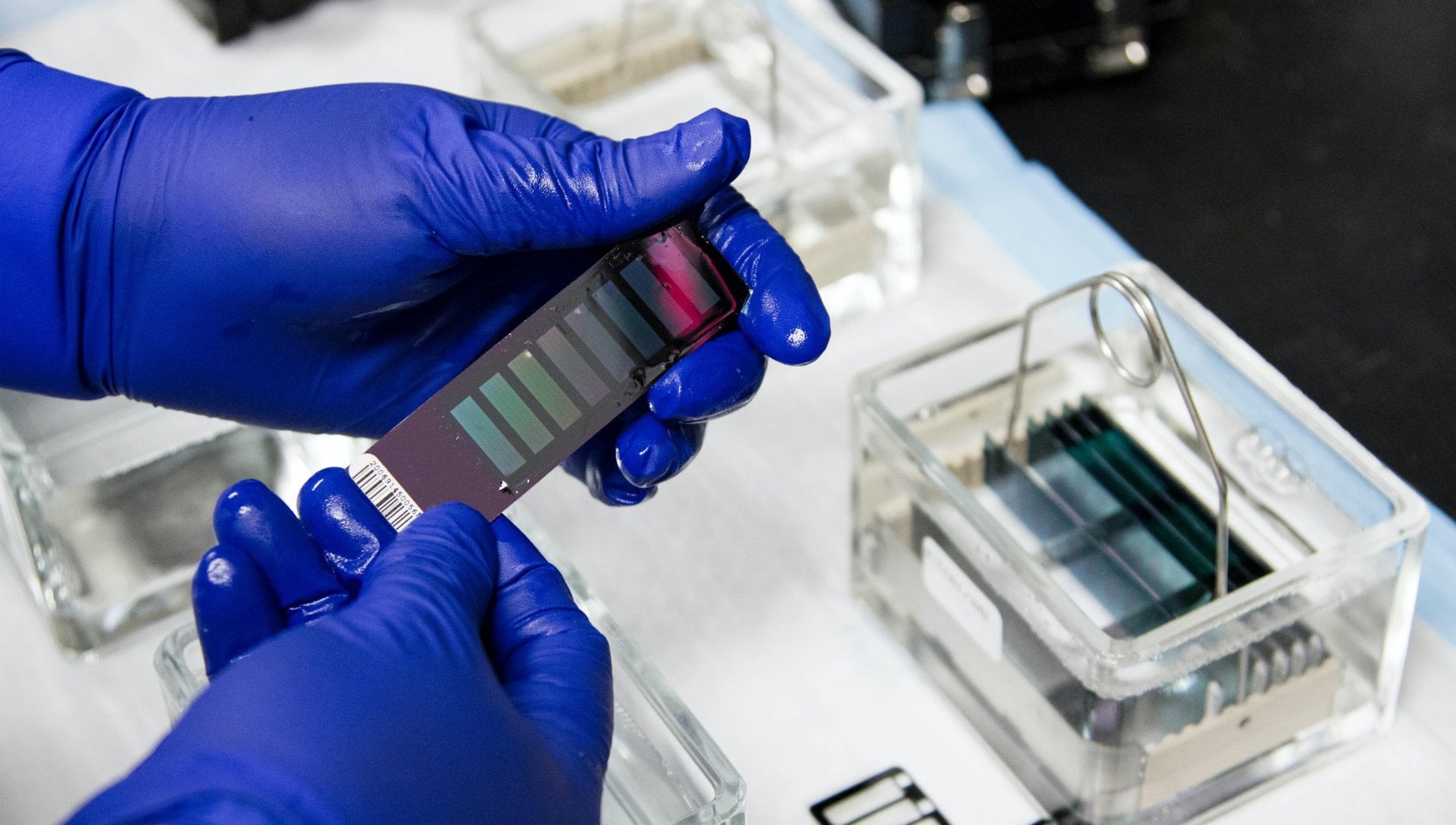 Tumore al seno avanzato, poche donne accedono al test genetico - la