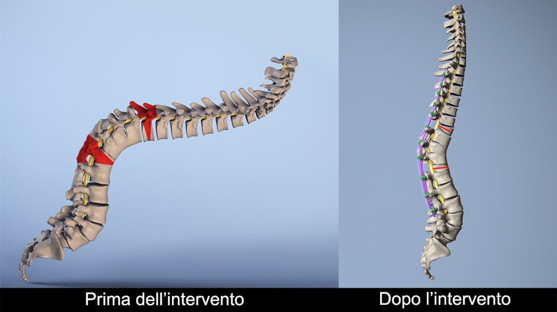 La colonna prima e dopo l'intervento