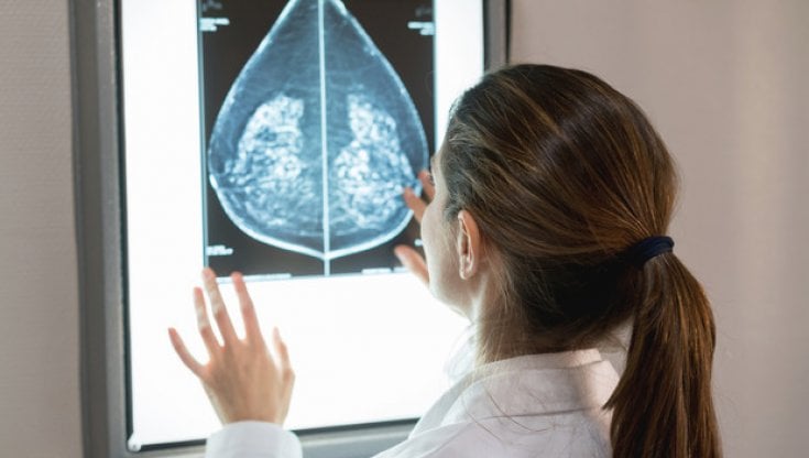 Cancro al seno: la nuova sfida è arruolare il sistema immunitario