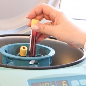 Medicina rigenerativa: cellule staminali per misurare il benessere
