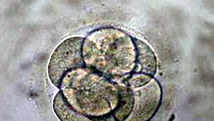Fecondazione, l'embrione con il Dna di 3 genitori si sviluppa normalmente