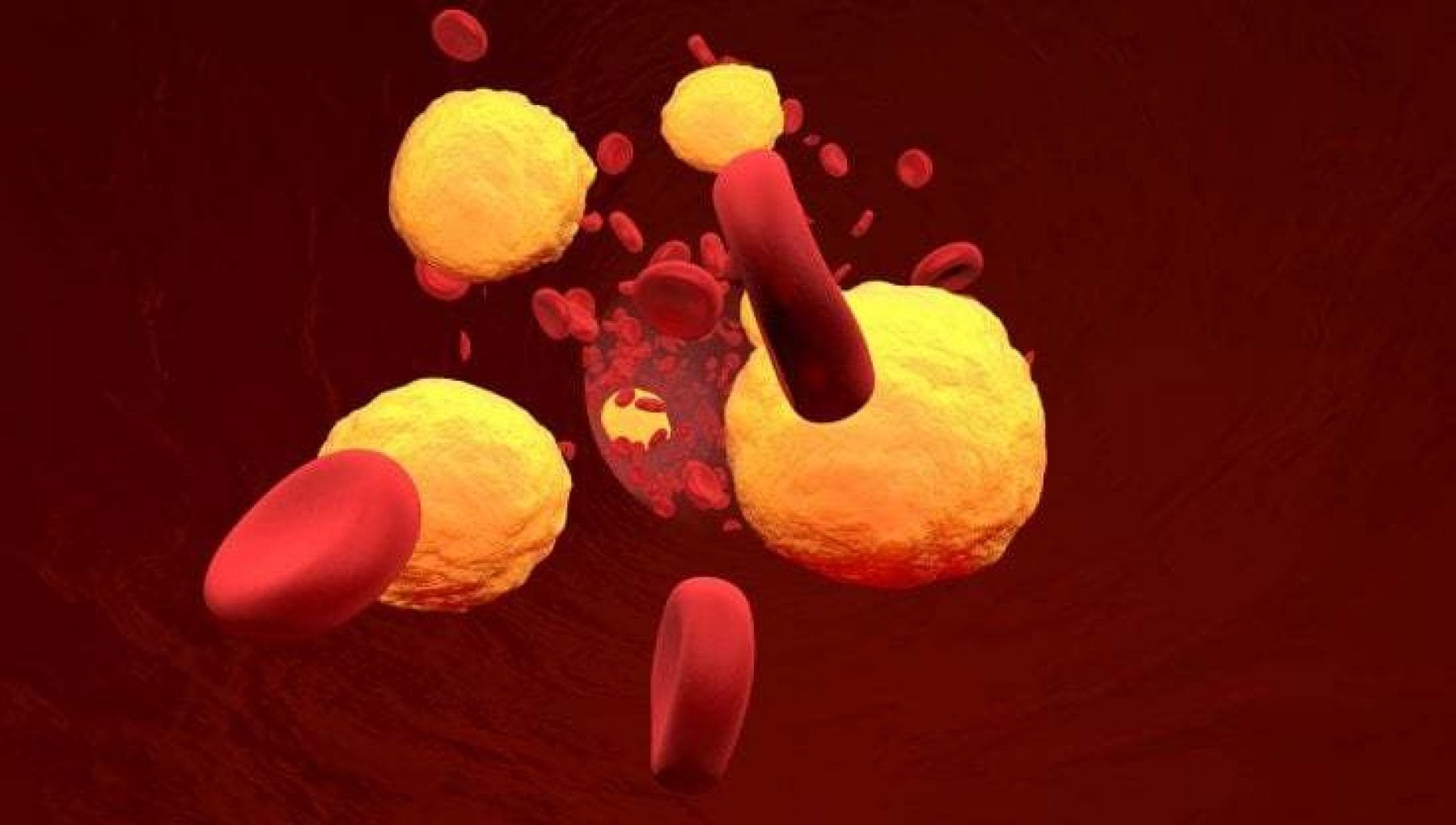 What To Eat To Keep Good Cholesterol Levels Up Breaking Latest News