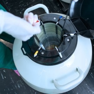 Fertilità, congelamento degli ovociti solo per le donne con tumore. Ma il Ssn non dimentichi le altre pazienti