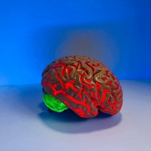 Tumori del cervello, la prima terapia target raddoppia la sopravvivenza libera da progressione