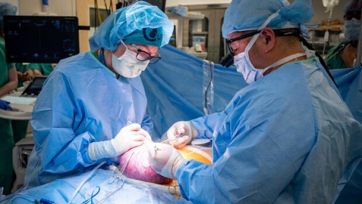 Gravidanza in utero fuori dall'addome, parto riuscito