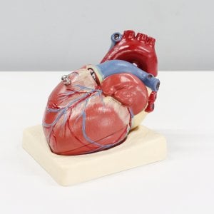Cardiomiopatia ipertrofica, la chirurgia può attendere