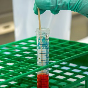 Linfoma follicolare, approvato in Italia un nuovo farmaco per le forme più difficili