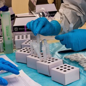 Influenza: attesi 5 milioni di casi e 10 milioni di virus "cugini". Ma c'è anche il Covid