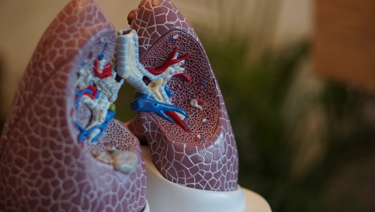 Reumatologia, la sfida dell’interstiziopatia polmonare si vince in team