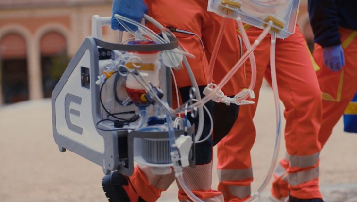 Trapianto di cuore non compatibile, salvo bimbo di 5 mesi grazie a nuova macchina per ECMO