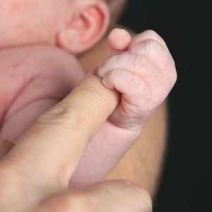 Bimbi pretermine: bene la sopravvivenza, ma il 90% soffre di disfagia 