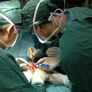 Angioplastica coronarica con palloncino medicato, quando serve e perché è utile