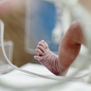 Neonati prematuri, se i polmoni sono malati al via test su una nuova terapia
