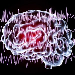 Epilessia, come si riconosce e come si interviene in caso di una crisi