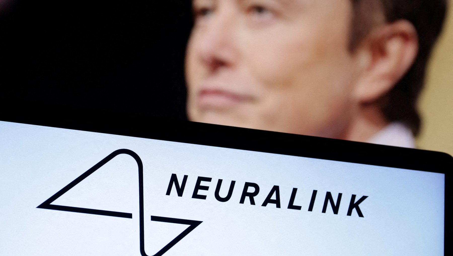 イーロン・マスク氏が人類初のNeuralinkインプラントを実施