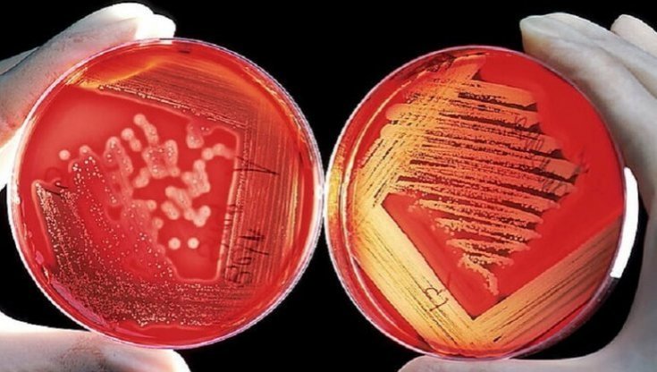 Trapianto di cellule staminali: un podcast per accompagnare donatori e riceventi
