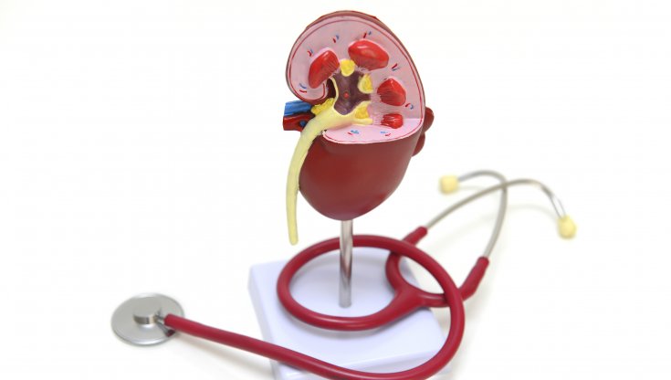 Diabete, un farmaco aiuta a prevenire i danni renali