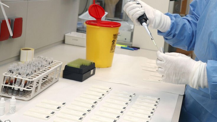 Raro caso di peste bubbonica identificato negli Stati Uniti 