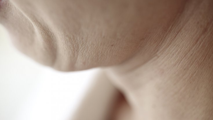Perché il collo invecchia prima? Ve lo diciamo noi 