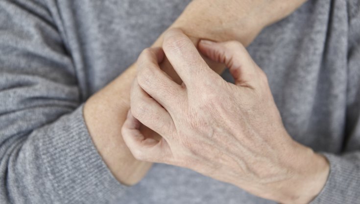 Non solo pelle: che cos'è la mastocitosi