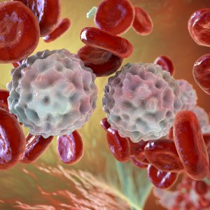 Linfoma, disponibile un nuovo farmaco per le forme più gravi
