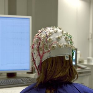 Epilessia, terapie sempre più 'a misura di paziente' ma c'è il nodo della farmacoresistenza