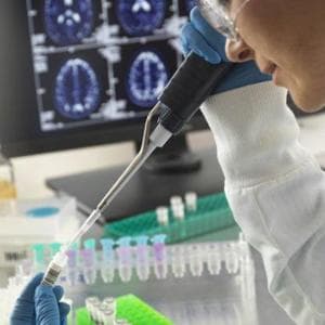 Alzheimer, l'intestino infiammato scatena la malattia