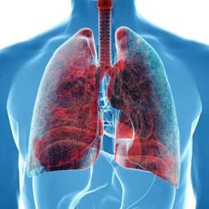 Tumore del polmone: nuove speranze da una terapia mirata