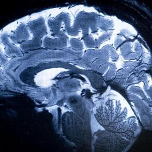 Gravidanza, ecco come modifica le aree del cervello