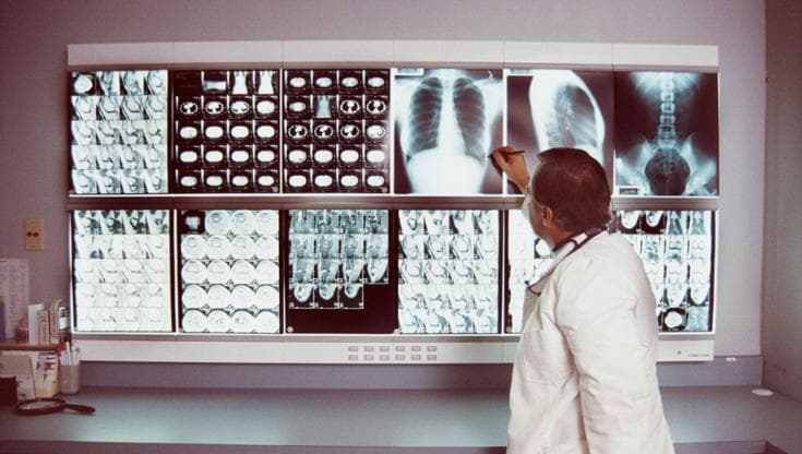 Radiologia medica, in Italia 70 milioni di esami l'anno