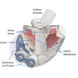 Il cuore artificiale totale: quando e perché serve (e forse servirà)