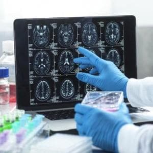 Prove incoraggianti per un vaccino contro il glioblastoma