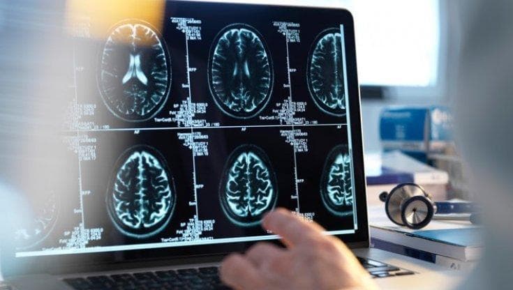 Salute del cervello, le dieci regole che ci salvano dalle malattie