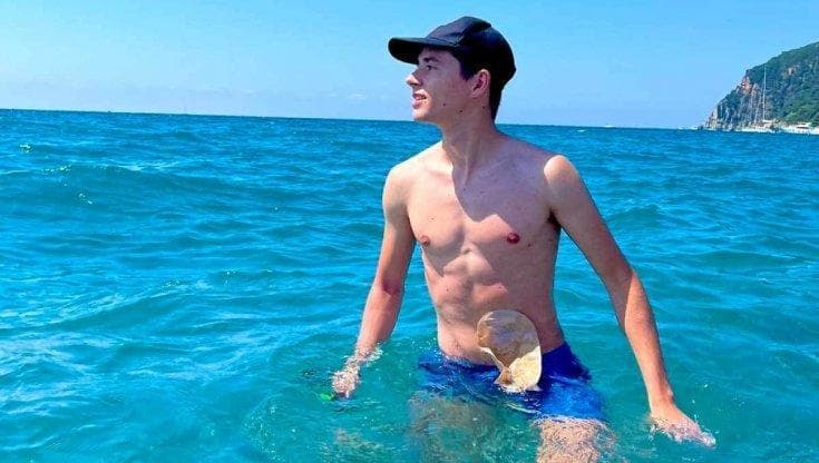 Francesco: "Racconto la stomia sui Social, così a 24 anni ho ripreso a vivere grazie a un sacchetto"