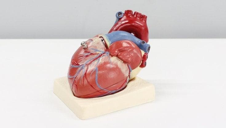 Cardiomiopatia ipertrofica, la chirurgia può attendere
