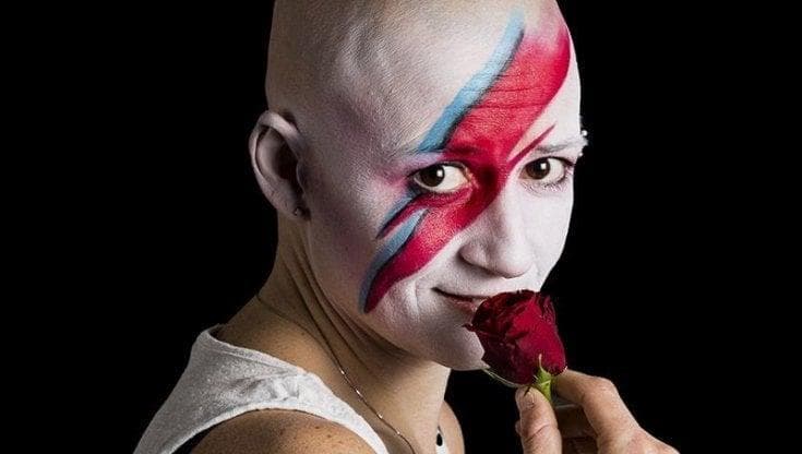 Senza capelli per colpa della alopecia. La psicoterapeuta: "Vi spiego come accettarlo"