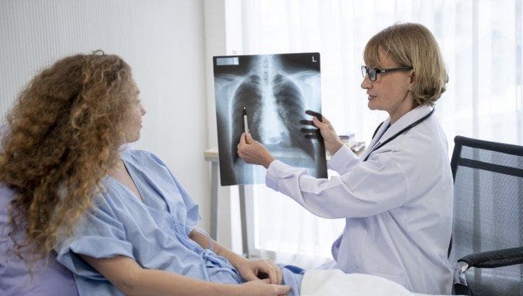 Tumore al polmone, sì l’immunoterapia dopo la chirurgia è efficace