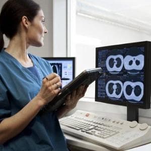 Tumore al polmone: con lo screening la sopravvivenza si allunga di oltre 7 anni