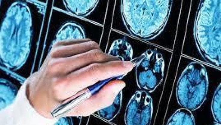 Alzheimer, la terapia del futuro arriva dai mitocondri