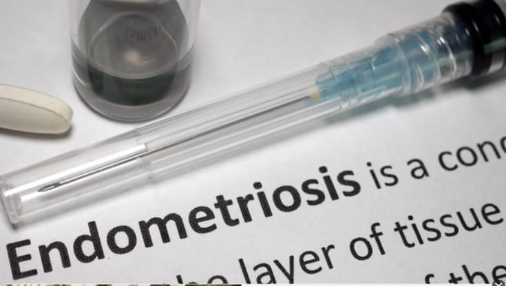 Giornata mondiale endometriosi, un ritardo di 7 anni nella diagnosi