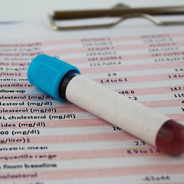 Colesterolo LDL, un punteggio per decidere a chi servono cure mirate per prevenire infarto e ictus