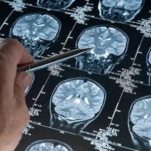La stimolazione magnetica transcranica per combattere l'ansia