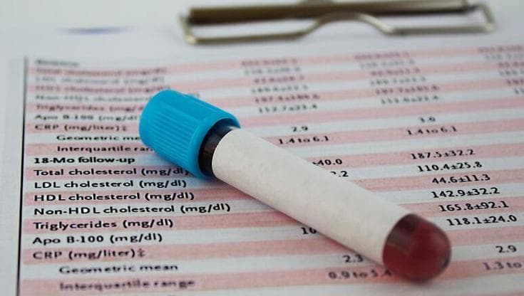 Non solo colesterolo, c’è un altro test del sangue per capire se c’è rischio infarto e ictus