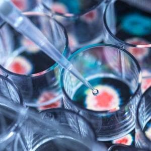 Biopsia liquida e tissutale: così il test doppio migliora la sopravvivenza nei tumori avanzati