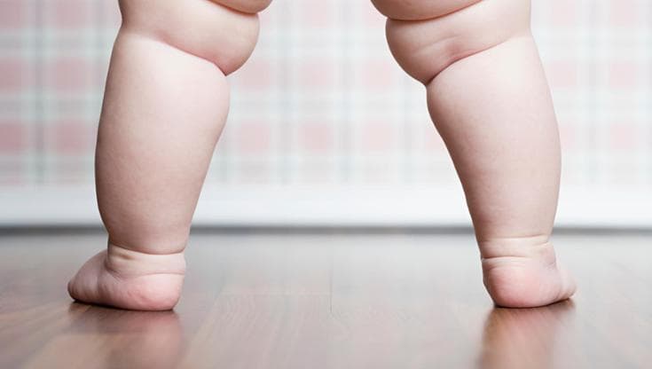 I bambini in sovrappeso saranno adulti a maggior rischio di sviluppare malattie respiratorie